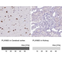 Plexin B3 Antibody, Novus Biologicals 25 &mu;L, Unlabeled:Antibodies, Polyclonal